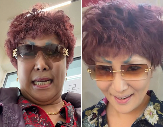 랄랄, 성형 후 확 달라진 얼굴에 혼란..."이명화가 너무 젊어져"