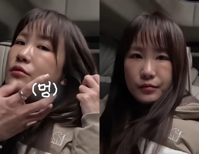 '김준호♥' 김지민, 심상치 않은 얼굴 상태...퉁퉁 붓고 멍 잔뜩 "욕실서 넘어져"