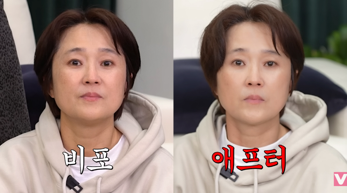 <b>송은이</b>, 조권 괄사 단 3분 효과 "눈 커지고 리프팅"…동안 비결 찾았다