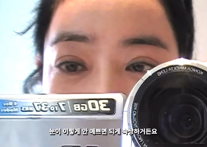 <b>이혜영</b>, 폐암 투병후 퉁퉁부은 눈 "좌절 많이 해, 온몸이 흉터 투성이"