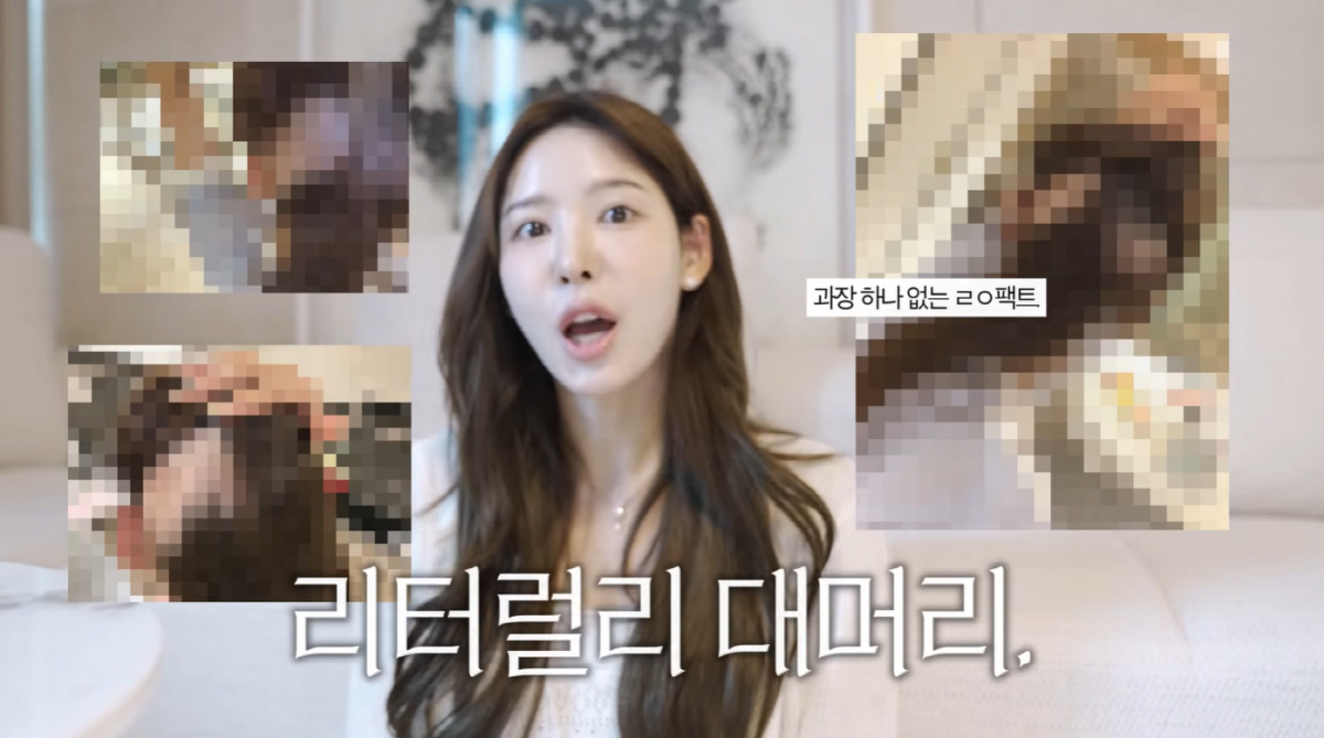 '환연2' <b>이나연</b>, 모발이식 부작용 <b>머리</b> 30cm 빠지고 오열.."하얀 두피가...