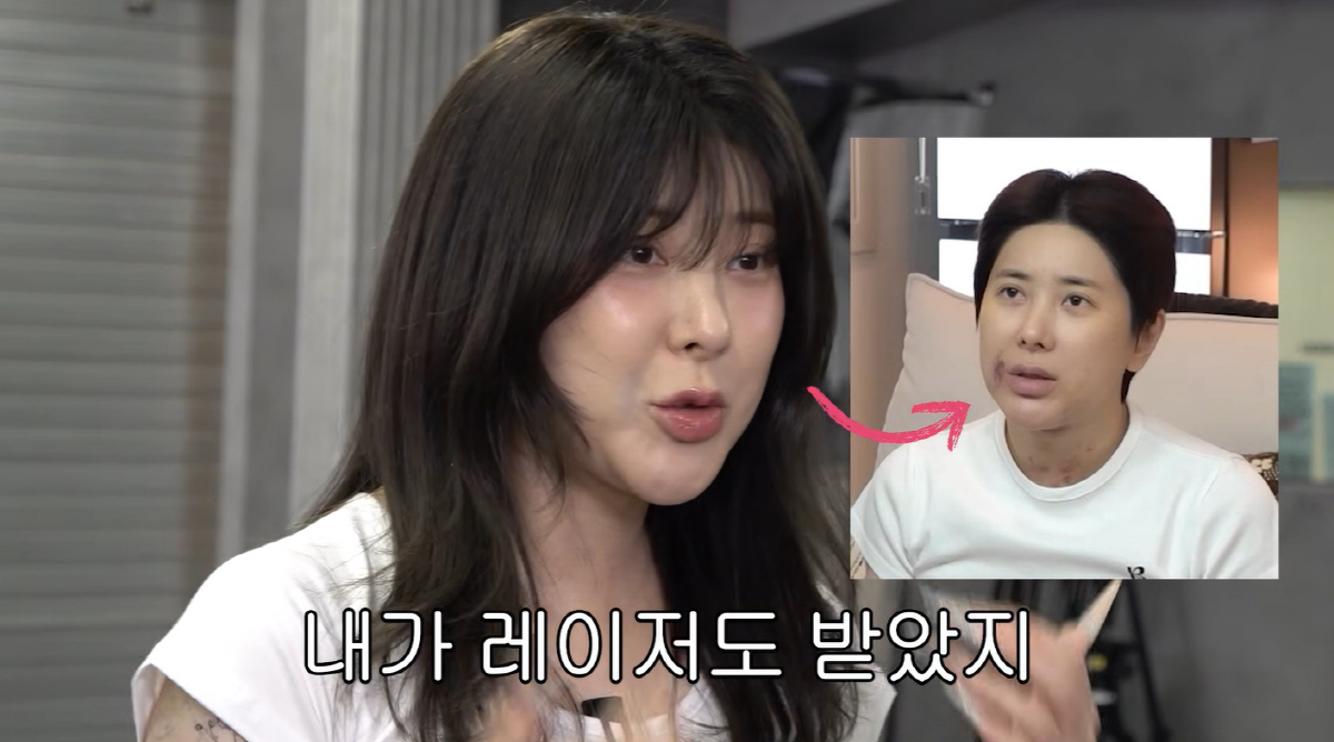 <b>서인영</b>, '얼굴 레이저·팔뚝 지방흡입' 확 달라진 얼굴 "'<b>워터밤</b>' 위해 ...