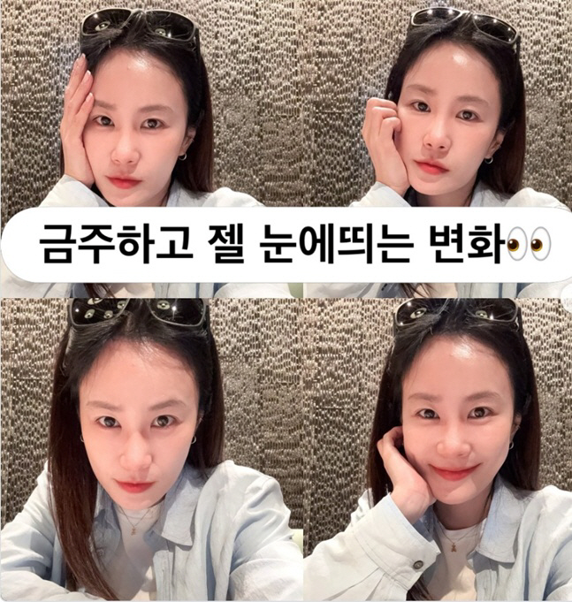 김지민, 김준호 위해 금주하더니 눈 흰자위까지 하얘졌다?