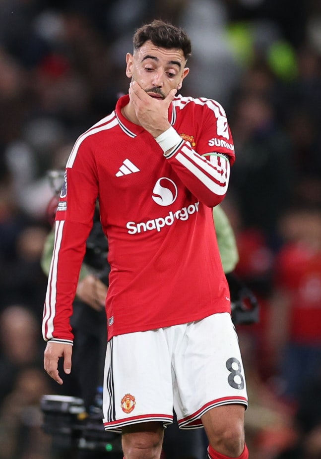 epa13295080 Bruno Fernandes of Manchester United reacts after the English Premier League match Manchester United against Tottenham Hotspur, in Manchester, Britain, 10 October 2026. EPA/ADAM VAUGHAN EDITORIAL USE ONLY. No use with unauthorized audio, video, data, fixture lists, club/league logos, 'li