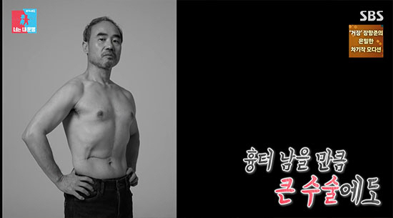 <b>강신일</b>, 47세에 <b>간암</b> 판정…"부채 많아 수술 2주만에 복대 차고 촬영"