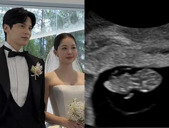 <b>김가은</b><b>윤선우</b>, 10년 열애 끝 결혼하더니…1년 만에 <b>임신</b> '겹경사'