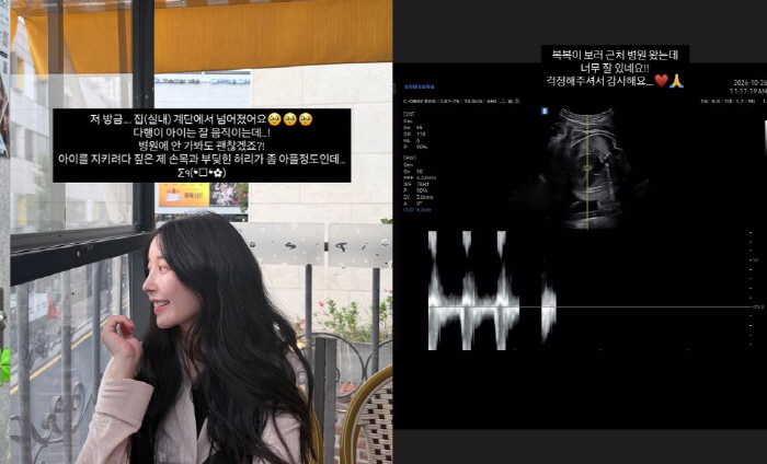 '<b>이지훈</b>' <b>아야네</b>, <b>만삭</b>에 계단서 '낙상 <b>사고</b>'…"아기 지키려다 허리 ...