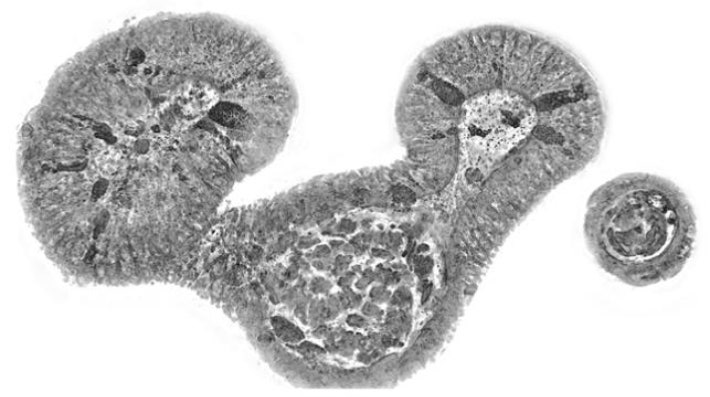 Cross-sectional image of gut organoid measured by research team. Provided by KAIST