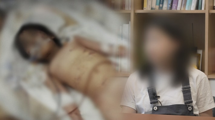 "새엄마가 시켰어"…생후 44개월 의붓딸 죽음의 진실은