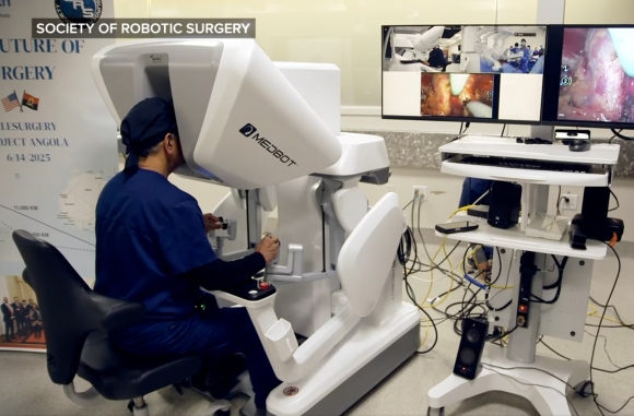 Dr. Vipul Patel in Florida, USA, is performing surgery on a cancer patient in Angola, southern Africa, over 10,000 km away. Photo=Society of Robotic Surgery
