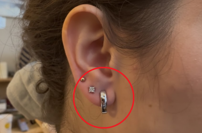 “귀걸이 아냐?” 자세히 보니 ‘깜짝’…女 귀 뒤에 숨은 반전 [포착]