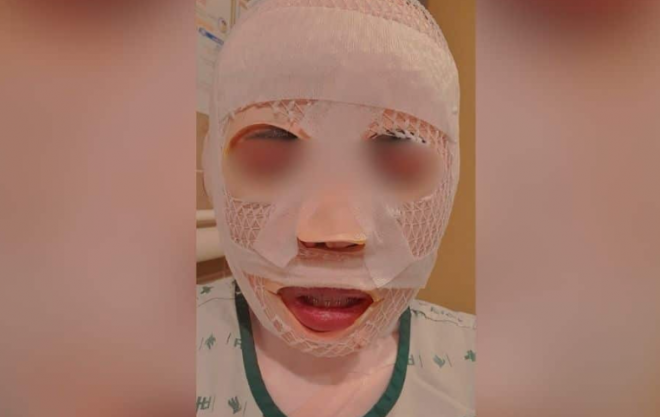 잠을 자고 있던 태국인 아내의 얼굴에 끓는 물을 부어 화상을 입힌 40대 한국인 남성이 경찰에 붙잡혔다.이 남성은 아내가 다른 남성을 만나는 것이 두려워 이 같은 범행을 저질렀다고 주장했다.페이스북