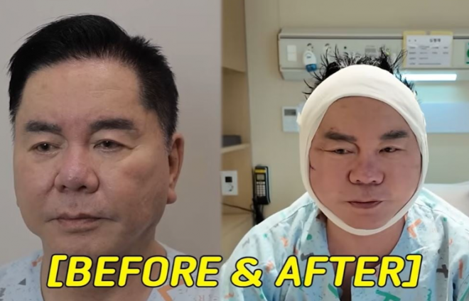 심형래 유튜브 채널‘영구TV’동영상 캡처