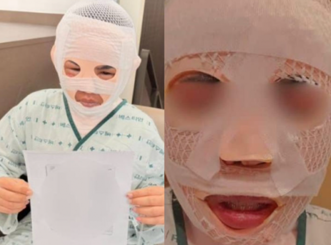 “딴 남자 못 만나게” 아내 얼굴에 끓는 물 부은 40대男… 눈물로 선처 호소했지만