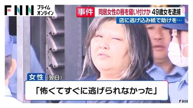 “도와주세요. 말을 못해요” 동거녀 입술 꿰매는 엽기 범행 저지른 日여성