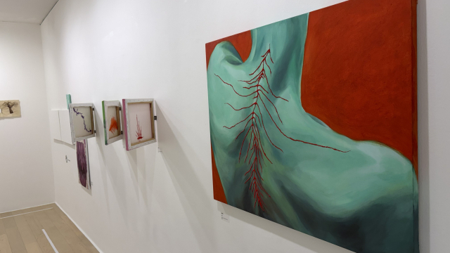 ‘2026 아티스타트’에서 장려상을 받은 하신아 작품. 희귀질환인 '트리메틸아민뇨증'을 소재로 한 시리즈이다. 김은영 기자 key66@