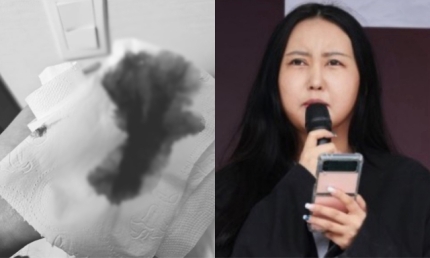 최서원(개명 전 최순실)씨의 딸 정유라씨가 객혈 사진을 SNS에 공유했다. 페이스북, 연합뉴스