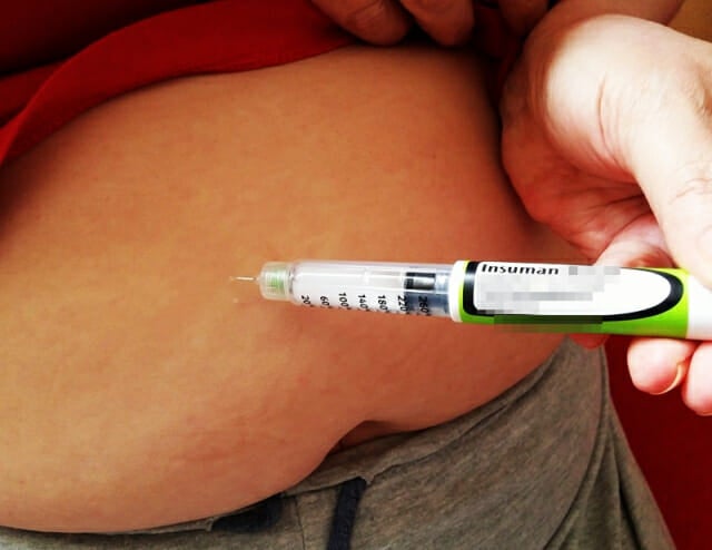 0002398602_001_20251116121112458.jpg?type=w800