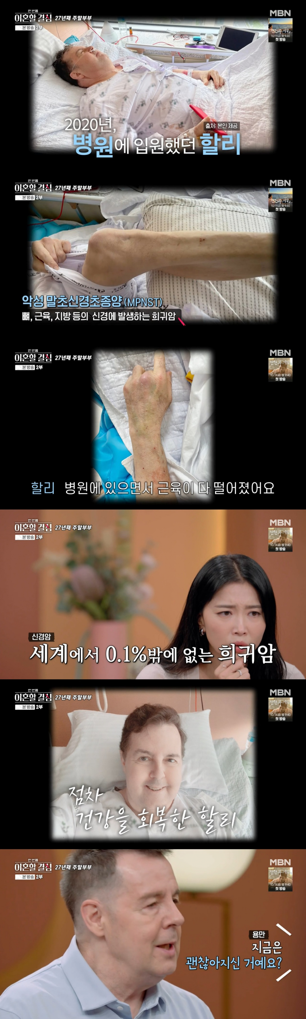 <b>로버트 할리</b>, 마약 투약→<b>희귀암 투병</b>.."근육 다 녹아" [한이결][별별TV...
