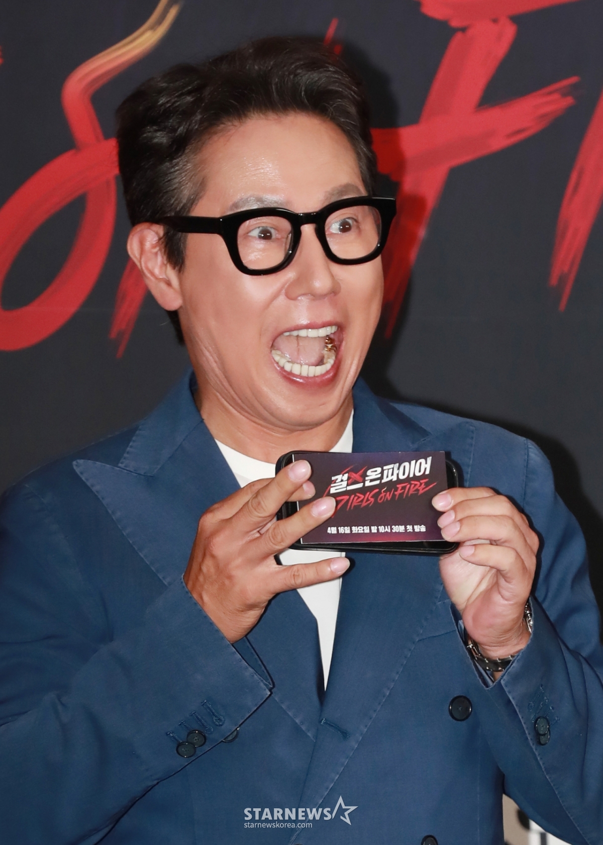 <b>윤종신</b>, 30년째 희귀병 탓.."오해 마시길, 고약한 친구" 안타까운 해명