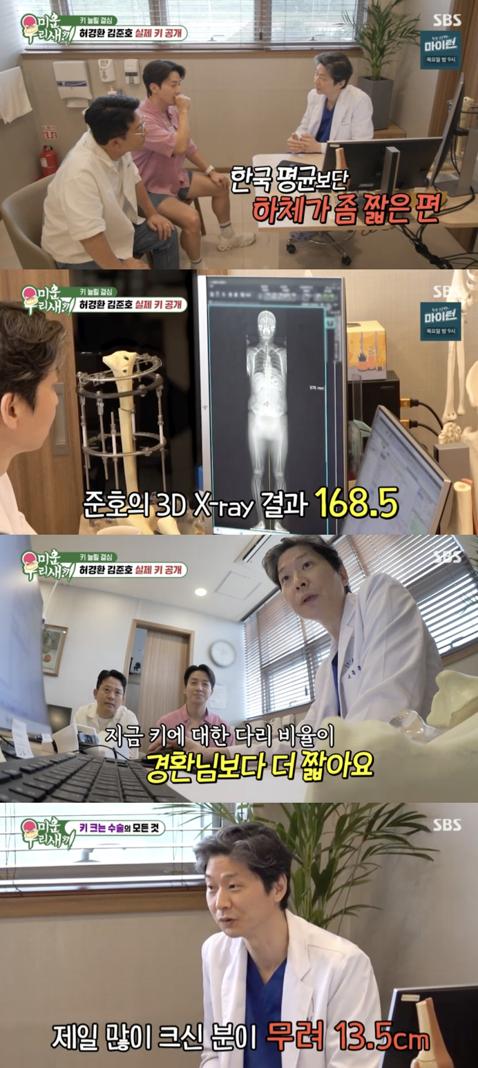 <b>허경환</b>, 실측 <b>키</b> 168.2cm.."결혼 못한 건 <b>키</b> 때문, <b>수술</b> 의지有" [미우새...