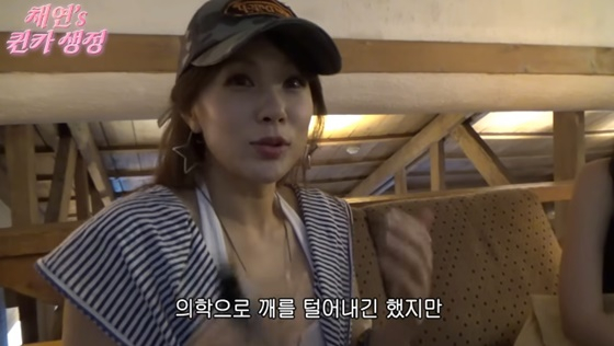 채연, 주근깨 제거 시술 인정 "백옥 같은 피부는 NO..흔적 남아"