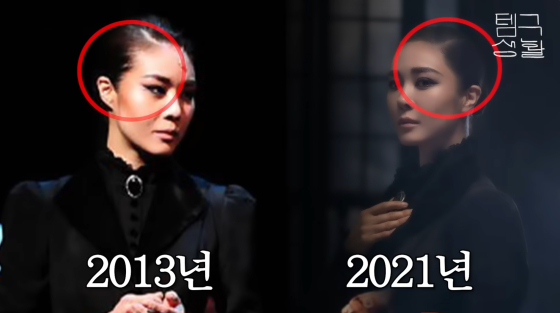 <b>옥주현</b>, 탈모+<b>모발 이식 부작용</b> 고백 "잔머리 사라져..억만금 줘도 안 돼...