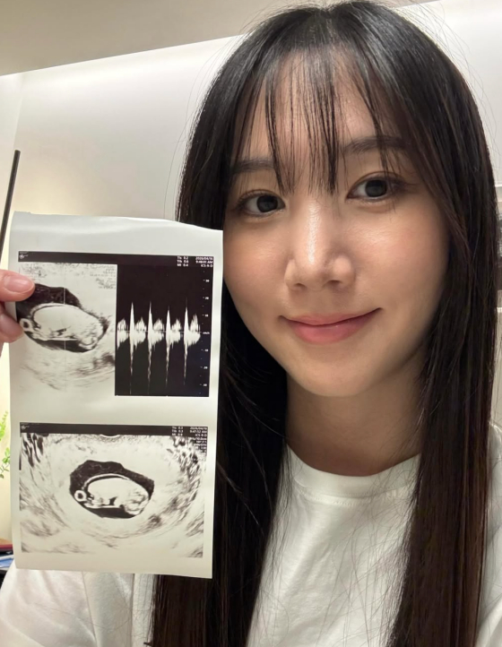 에이핑크 출신 <b>홍유경</b> "<b>임신</b> 16주차, 태명은 당당이"..결혼 3년 만 경사...