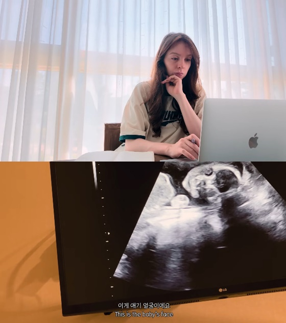 '<b>박주호</b>' <b>안나</b>, 암 투병 딛고 <b>넷째 임신</b> "힘든 시간 버티고 찾아온 희...