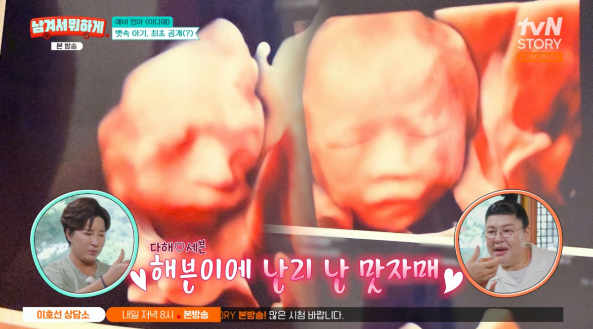 '12월 출산' <b>이다해</b>, <b>딸 초음파</b> 공개 "코는 확실히 아빠 <b>세븐</b> 닮아"[남겨...