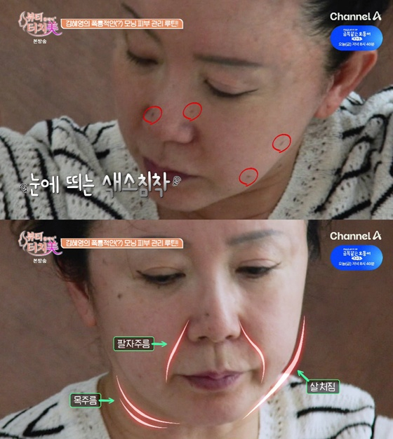 색소침착, 팔자주름, 목주름, 살 처짐이 표시된 김혜영의 얼굴 / 사진=채널A