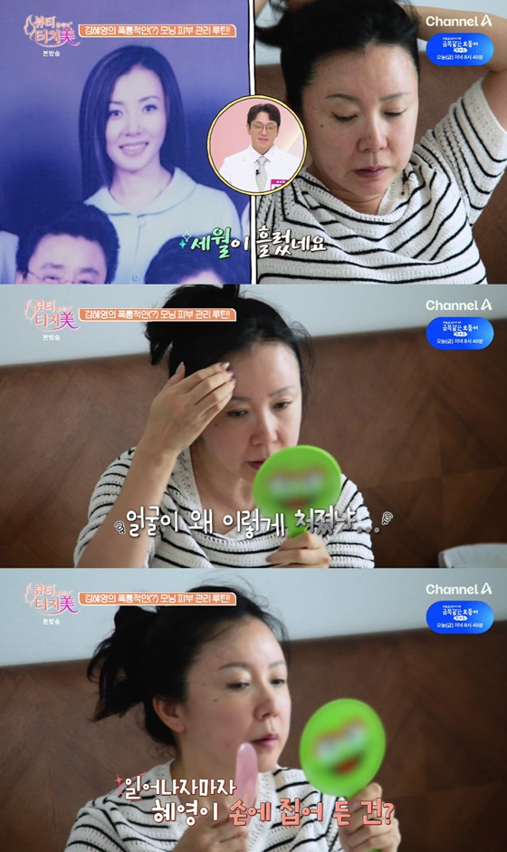 김혜영 얼굴 변화, 8년 공백 뒤 밝혀진 진짜 이유