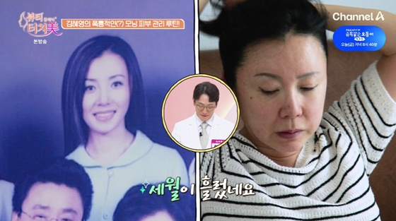 '귀순 아이유' <b>김혜영</b>, <b>이혼</b>·사기 겪고 <b>급속 노화</b>..주름 생긴 얼굴 "8kg...