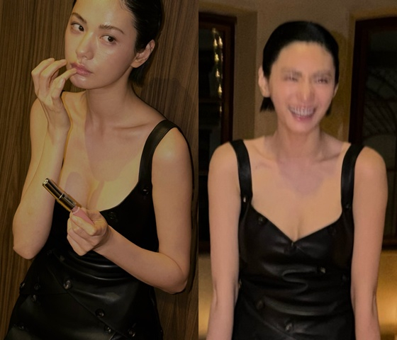Nana Apologized for Her Lip Filler. Now She's Showing Exactly What Changed.