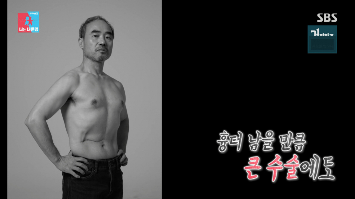 <b>강신일</b>, <b>간암 수술</b> 2주 만에 <b>복귀</b>한 사연.."가장 큰 이유? 책임감"[동상...