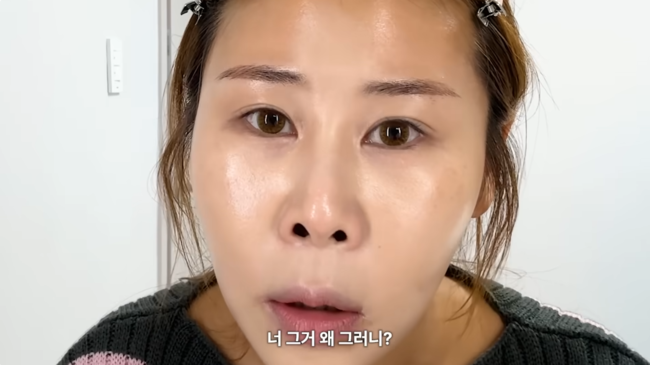 <b>박세미</b>, 최초 <b>고백</b> "중3 때 첫 <b>성형</b>수술, 앞트임 약속 안 됐는데 수술 후...