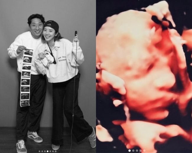 ‘4월 출산’ <b>손담비</b>, <b>2세</b> 비주얼 공개..이목구비 뚜렷 “<b>이규혁</b> 닮은...