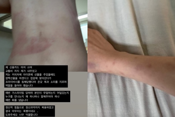 "<b>전호준</b>, 14살 연하 여친에 <b>성병</b> 옮기고 <b>폭행</b>"..前연인 폭로 <b>논란</b> [Oh!쎈...