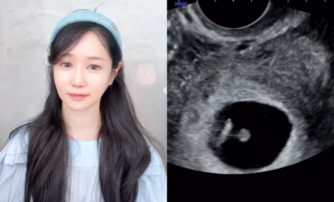 '돌싱' <b>나솔 16기 옥순</b>, '<b>혼전임신</b>' 깜짝 발표 "한번에 성공..믿기지 않...