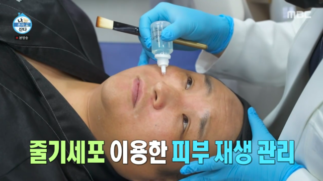 <b>백반증</b> 뭐길래..<b>구성환</b>, 눈→입 주변 하얗게 변해 “난치성에 스트레스...