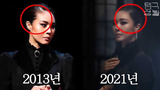 '45세' <b>옥주현</b>, 탈모→<b>모발이식</b> 고백..<b>부작용</b>에 '스트레스' "잔머리 실종...