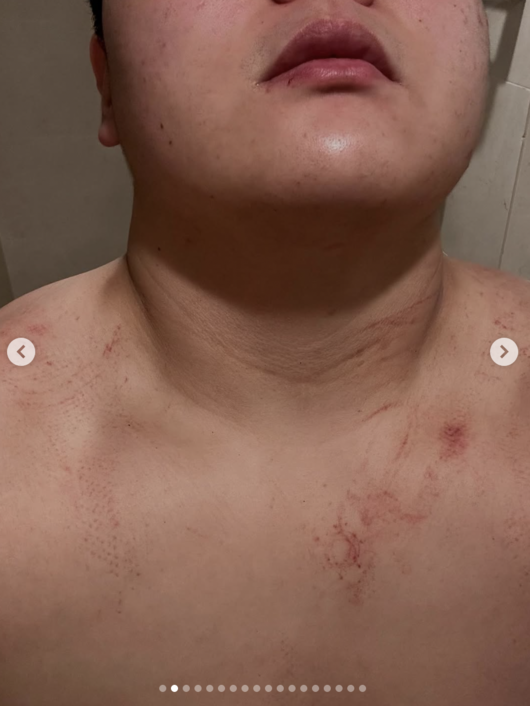 0005433404_002_20251119062415996.png?type=w647