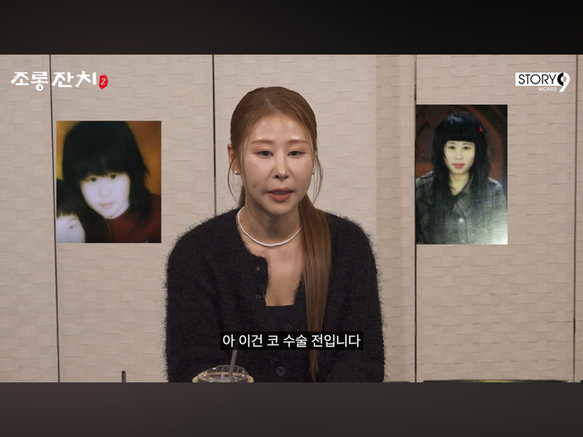 박세미, 20KG 감량 후 코 수술 전 사진 공개