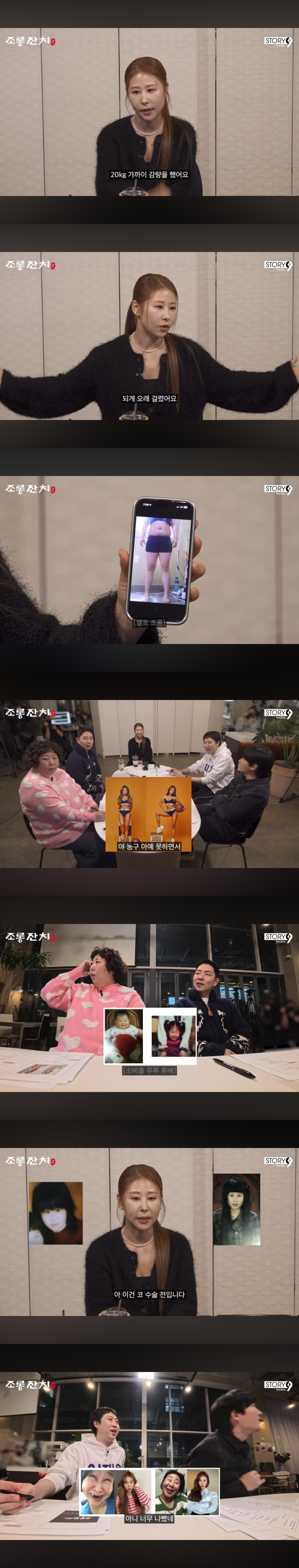 박세미, 20KG 감량 후 코 수술 전 사진 공개