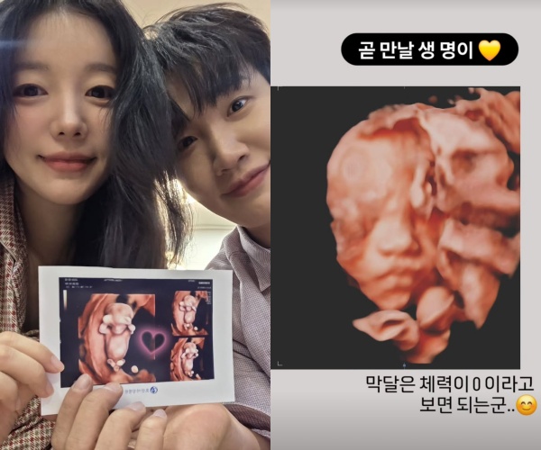 <b>문지인</b>, 아들 입체초음파 사진 공개…<b>김기리</b>와 똑같이 생긴 코에 ‘깜...
