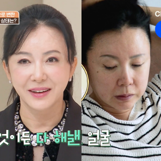 <b>김혜영</b>, '귀순 아이유'였는데..<b>이혼</b> 3번에 "8kg 찌고 이중턱" 충격 급노...