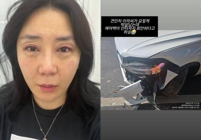 '박나래 탓 예능 폐지' 허안나, 결국 교통사고까지…"차 박살, 어지럽고 관절 아파"
