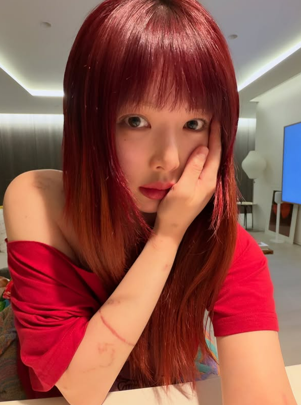 현아, 임신설 후 반쪽 된 근황…♥용준형 "내 아내, 마음고생 많았어"