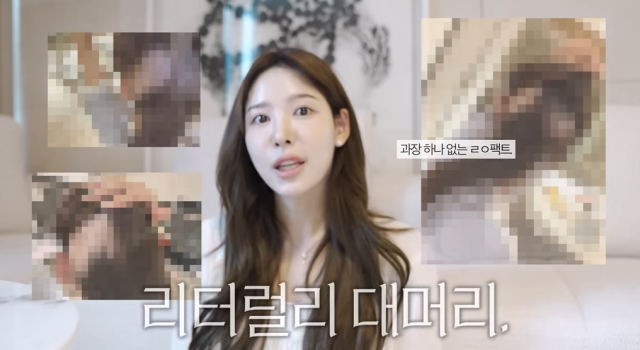 '환승연애2' 이나연, 심각한 탈모 고백 "<b>모발이식</b> 후 대머리 됐다" [마데...