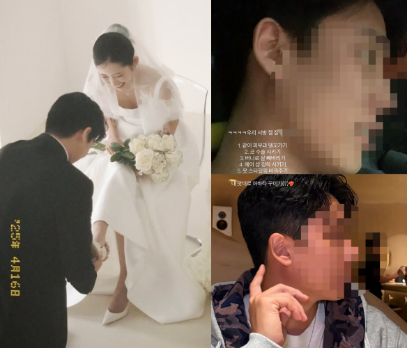 チェ・ジュニの結婚写真と、鼻の整形手術前後を写した夫の写真。顔にはモザイクがかけられている